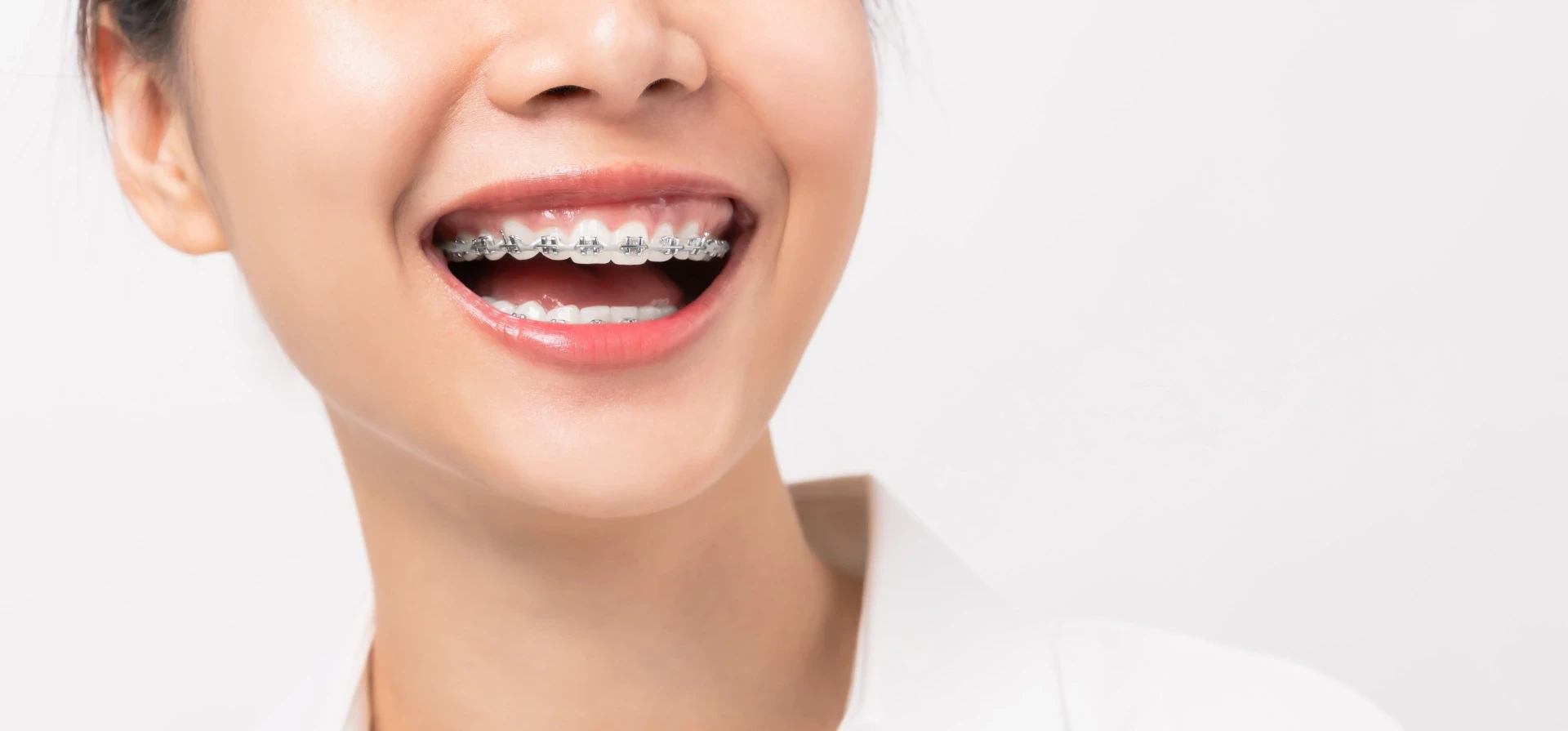 AMASS DENTAL - ĐIỂM ĐẾN ĐÁNG TIN CẬY CỦA DU KHÁCH PHƯƠNG TÂY