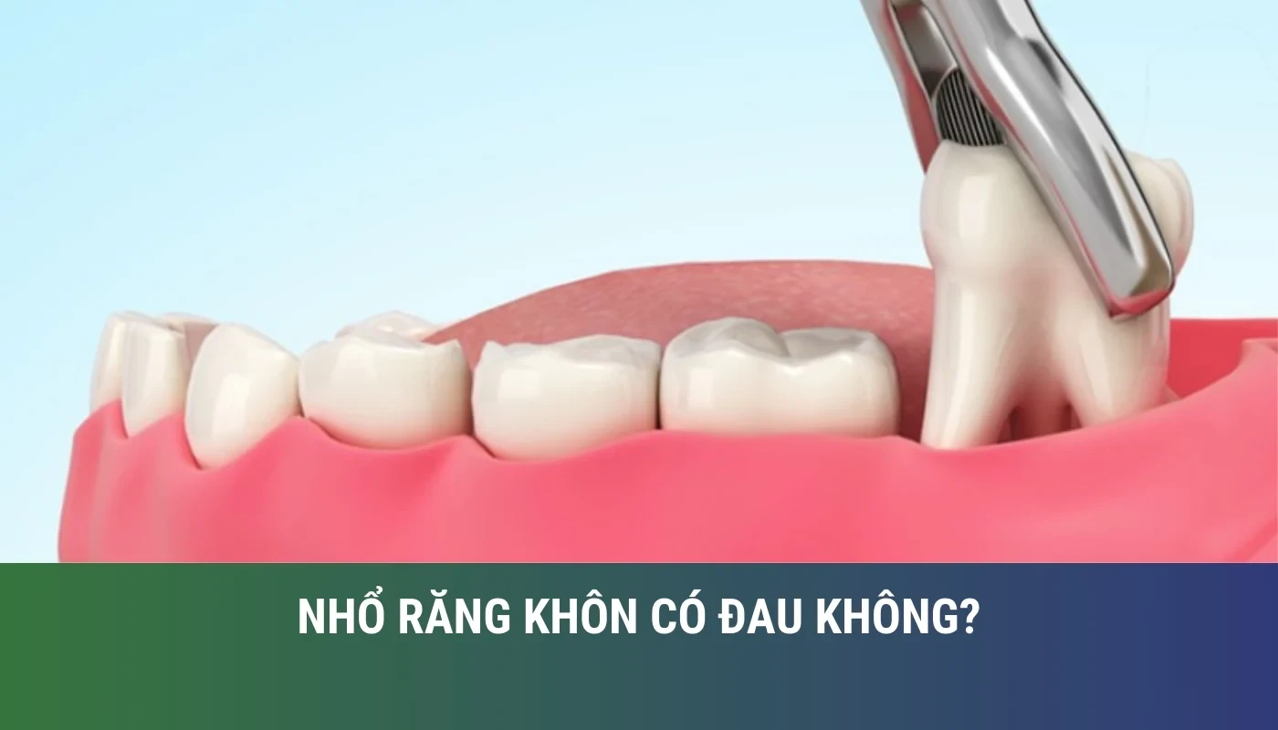 Nhổ răng khôn có đau không? Cách giảm đau như thế nào?