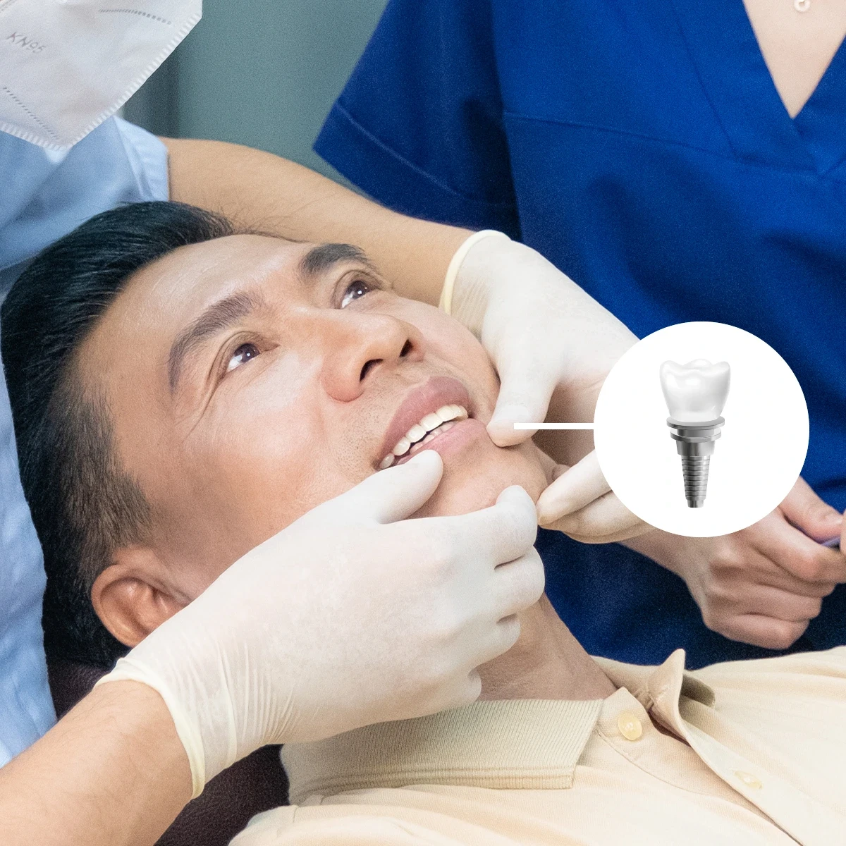 Trồng răng Implant